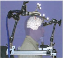 Brainsight scanner and TMS coil in place with simulated patient