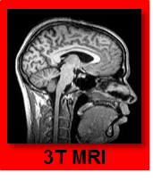 MPRAGE is an magnetic resonance imaging technique that gives 3D images with good constrast.