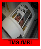 Simultaneous transcranial magnetic stimulation and functional magnetic resonance imaging allow direct imaging of the transynaptic effects of stimulation at a cortical location