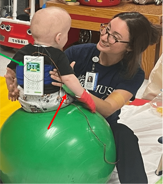 Therapist assists infant during cerebral palsy treatment